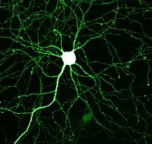 Яркая точка, тело нейрона, окружена множеством отростков, которые обеспечивают связь этой клетки с другими